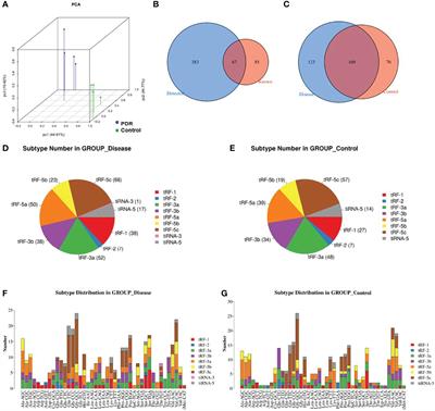 Altered Expressions of Transfer RNA-Derived Small RNAs and microRNAs in the Vitreous Humor of Proliferative Diabetic Retinopathy